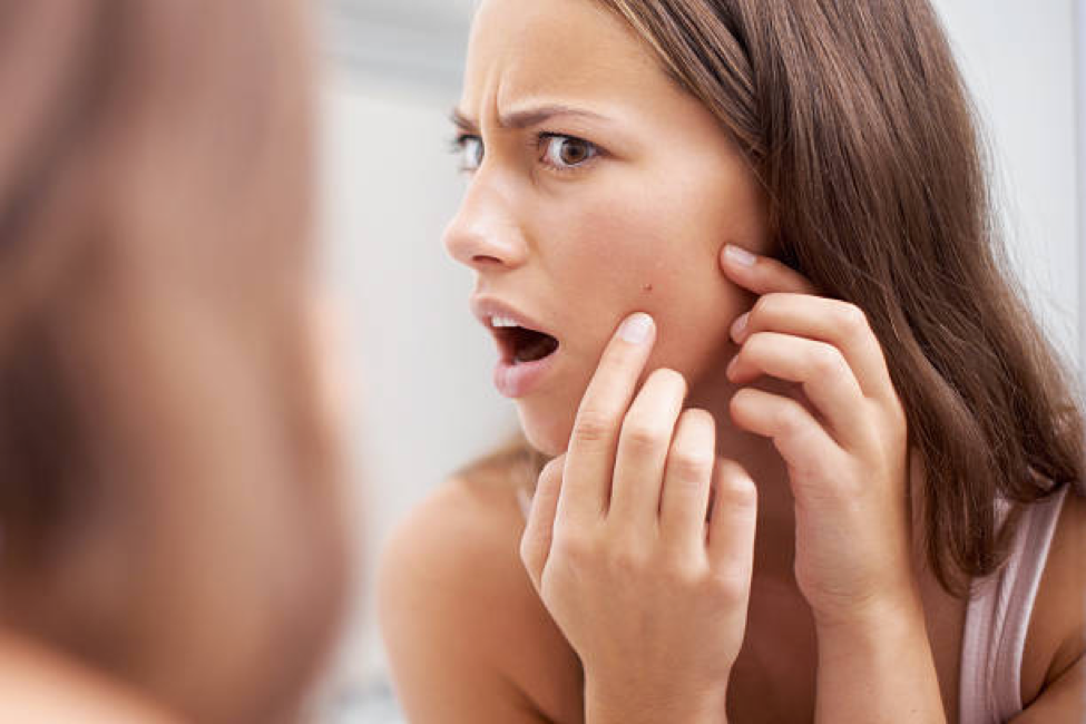 Top Tips for Overcoming Blemishes on School Picture Day